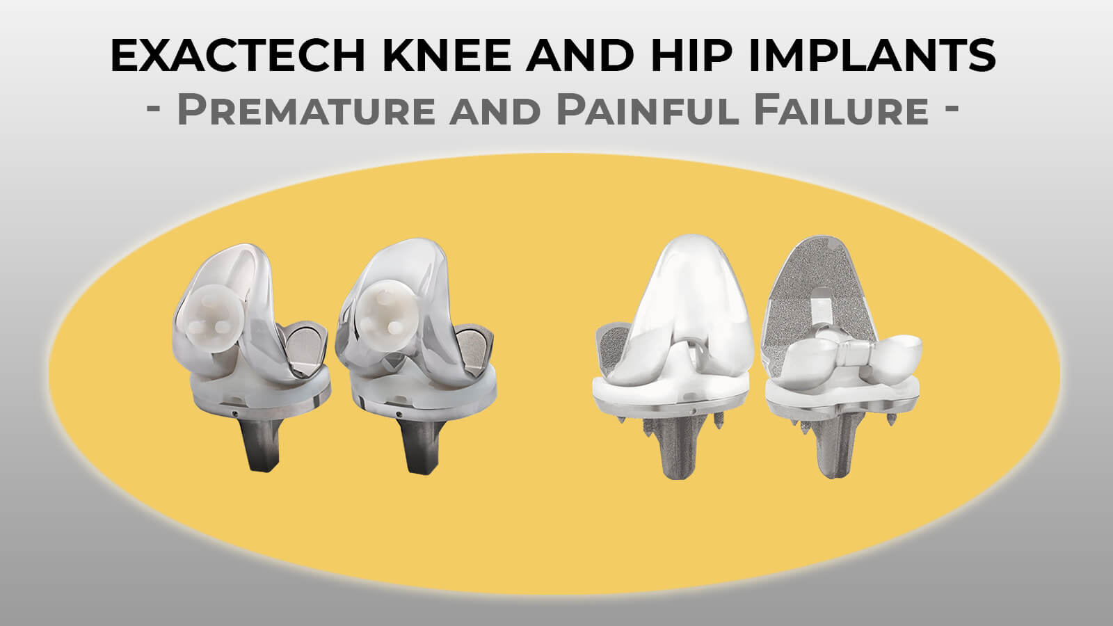 Exactech Knee and Hip Implant Investigation - Preuss